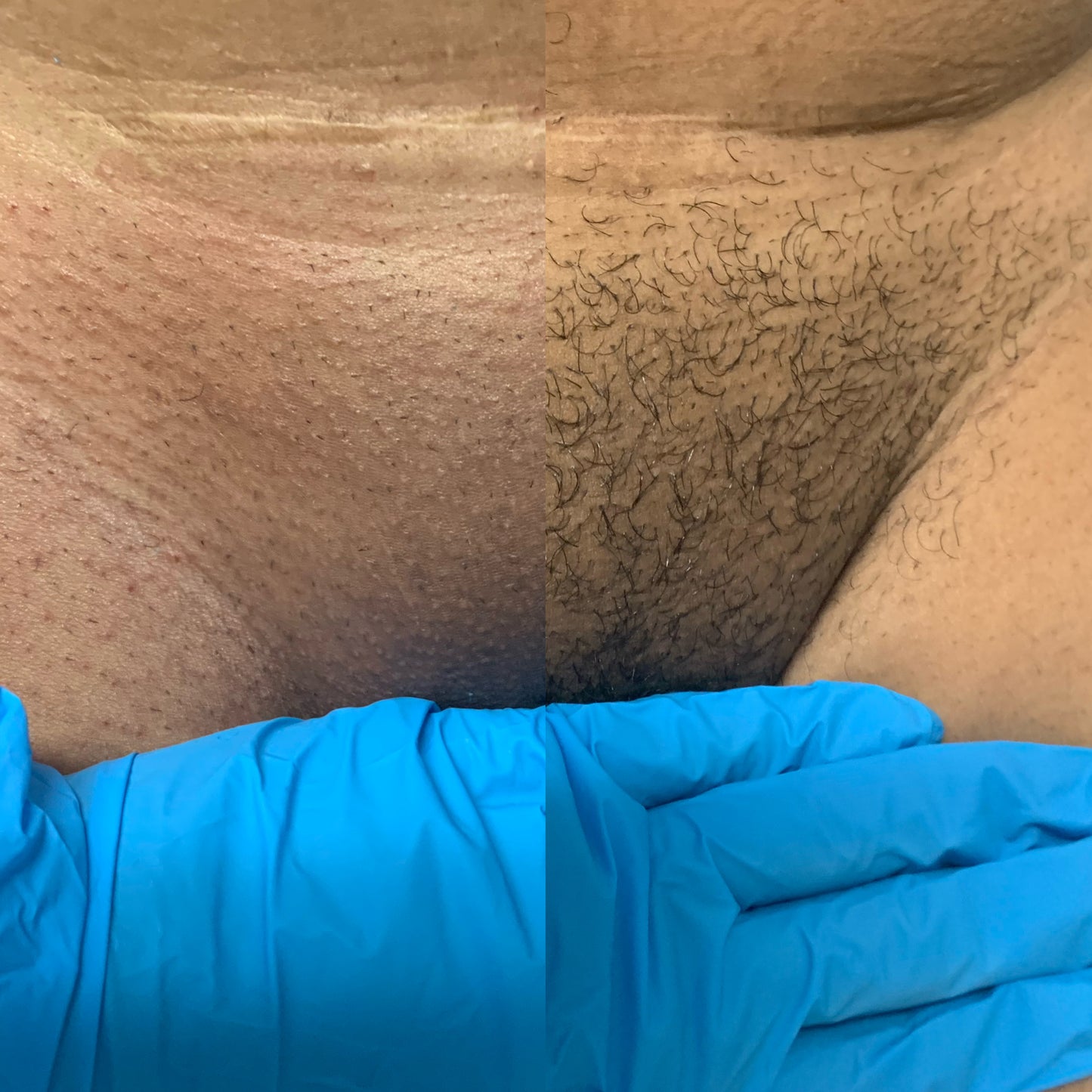Brazilian / Vajacial Special